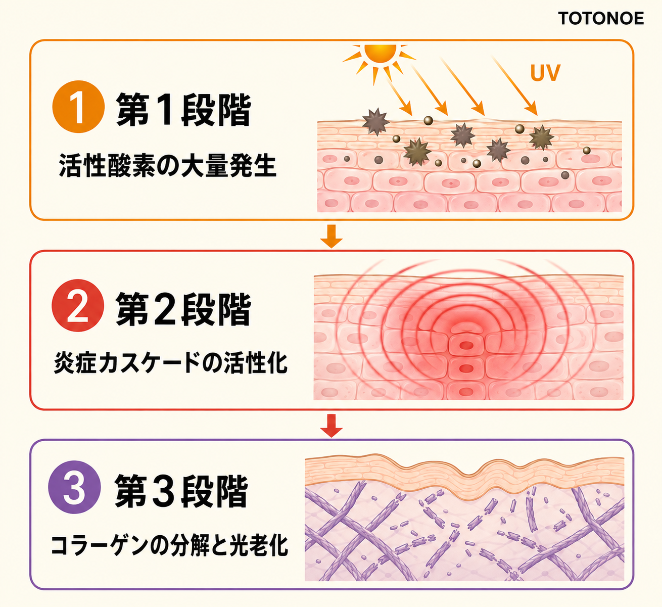 紫外線ダメージの3段階メカニズム図解。1活性酸素 2炎症カスケード 3コラーゲン分解の流れを矢印で示す